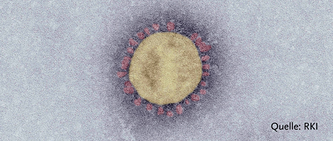 SARS-Coronavirus-2 (SARS-CoV-2)